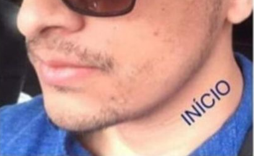 Homem com barba falha e cabelo ralo antes do tratamento